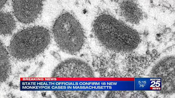 Massachusetts Monkeypox numbers up nearly 60 percent