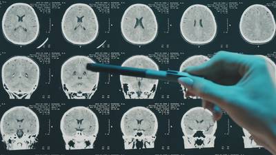 What looks like Parkinson’s may not be in CTE patients