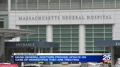 First case of monkeypox confirmed in Massachusetts