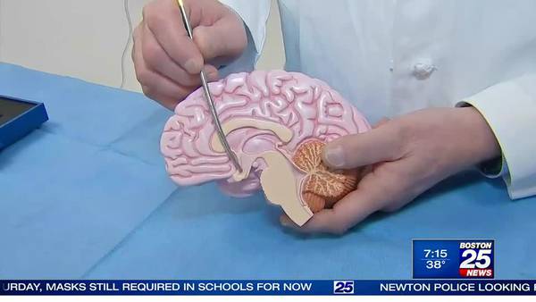 Doctors research brain surgery that could be used to treat obesity