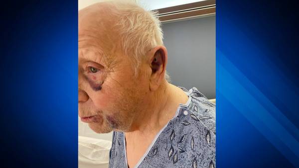 Police looking for bikers they say attacked 82-year-old man