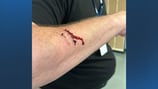 Revere teacher slashed with knife during brawl in school hallway, educators say