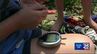Study finds pandemic spike in Type 2 Diabetes in children