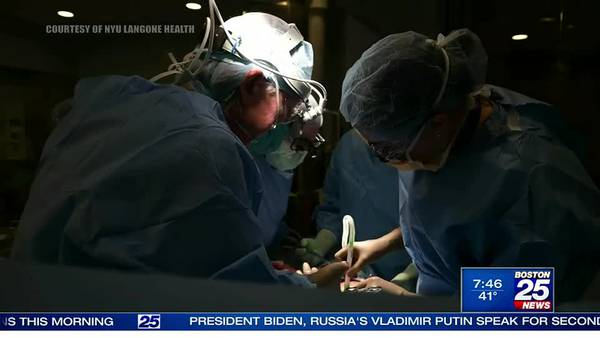 Pig-to-human organ transplant research means hope for patients