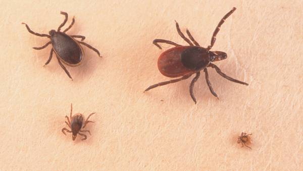 First confirmed case of rare, tick-borne Powassan virus reported in Mass. town