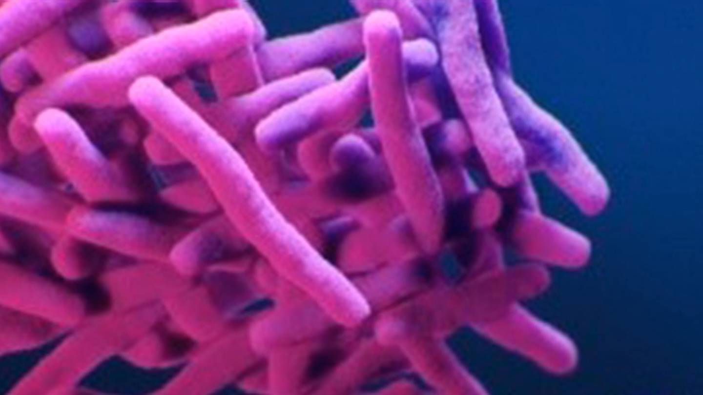 Massachusetts Town förnekar folkhälsokris trots tuberkulosoro – Boston 25 News