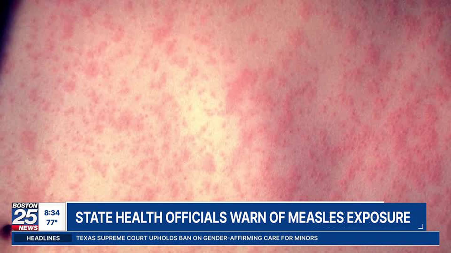 International passenger requests DPH measles warning Boston 25 News