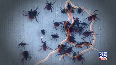 Doctors warning parents about misdiagnosing Lyme disease