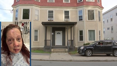 ‘Scared’: Woman left beaten and bloodied after targeted home invasion in Fitchburg