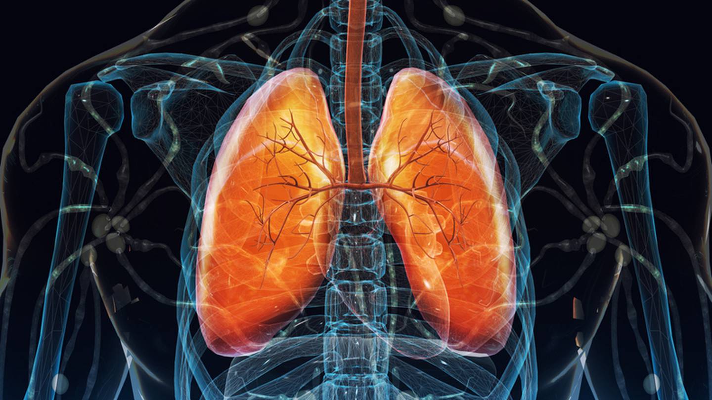 Il a été démontré que la pilule contre le cancer du poumon réduit de moitié les décès par cancer et la récurrence de la maladie – Boston 25 News